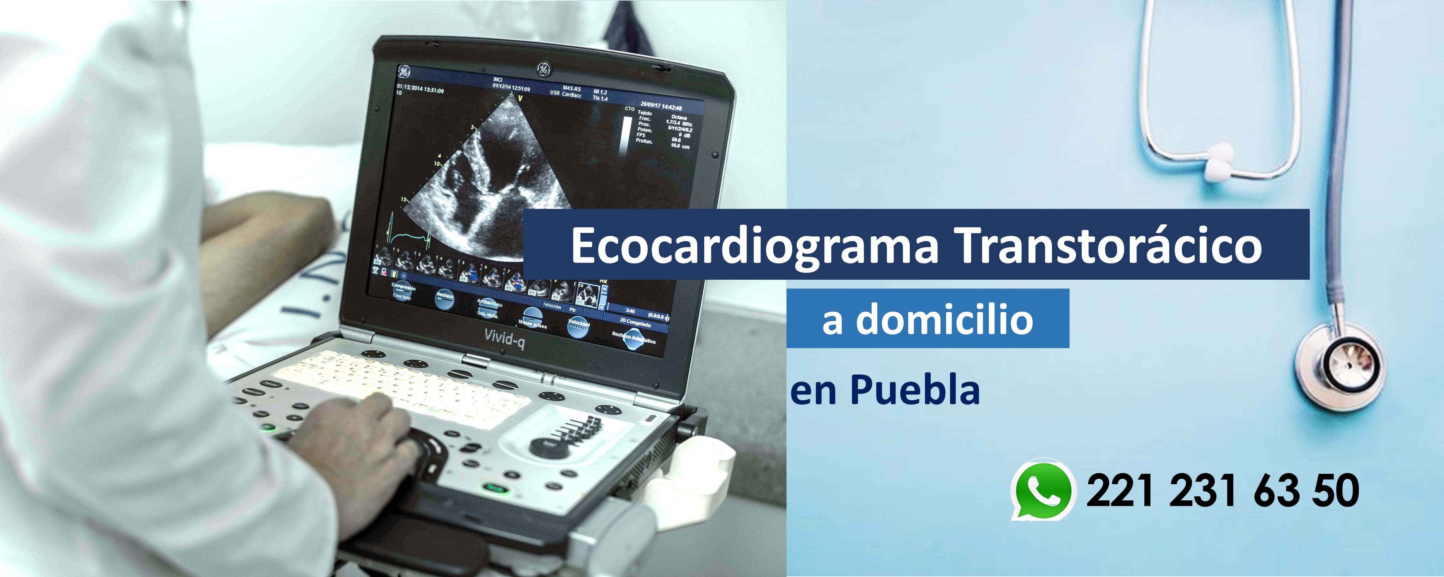 Cardiólogo en Puebla