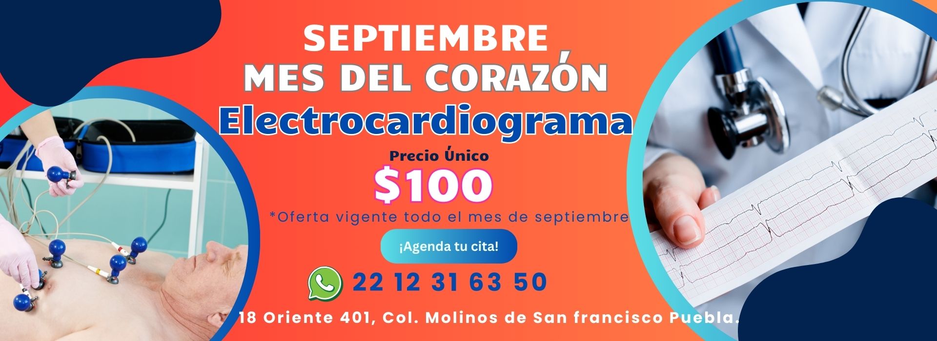 Cardiólogo en Puebla